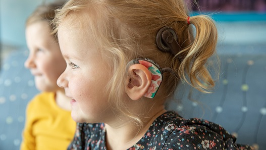 CochlearImplant News