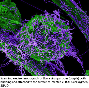 NIH 20221121 ebola