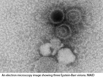 NIH 20221027 ebv micrograph