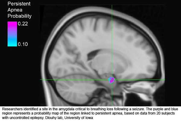 NIH 20231003 sleep apnea