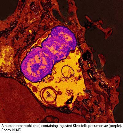 NIH 20230906 neutrophil