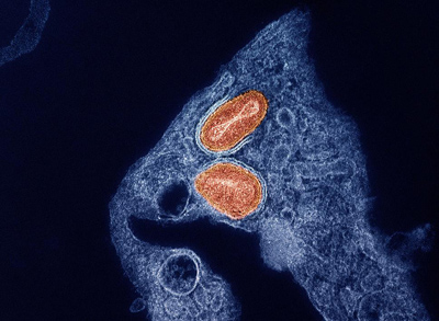 NIH 20241210 two mpox particles