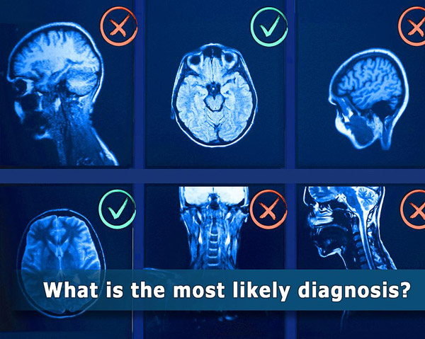 NIH six mri MRI scans