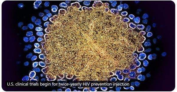 NIH HIV