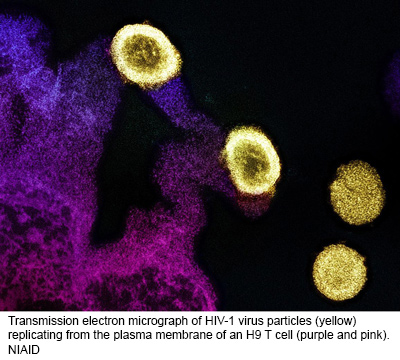 NIH 20240305 hiv tem 4 particles