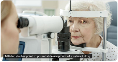 NIH cataract drug