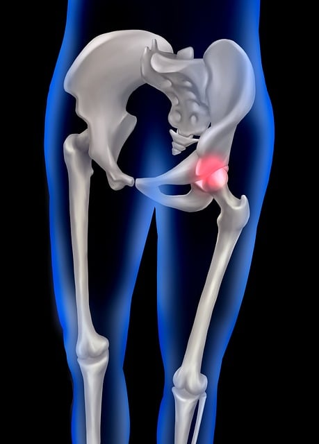 Hip Pain