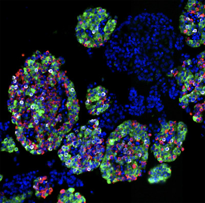 NIH 20260512 pancreatic